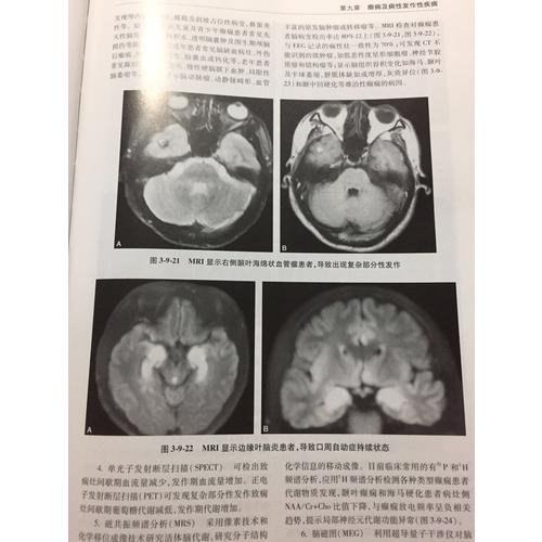 神经病学（第二版·上下)