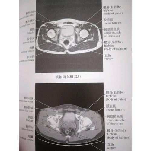 腹部影像解剖图谱